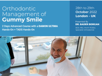 Orthodontic Management of Gummy Smile