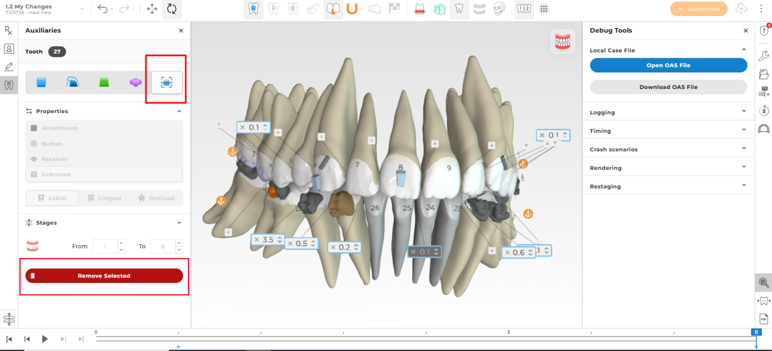 Ormco - Spark™ Releases - Latest Updates on Spark Aligners